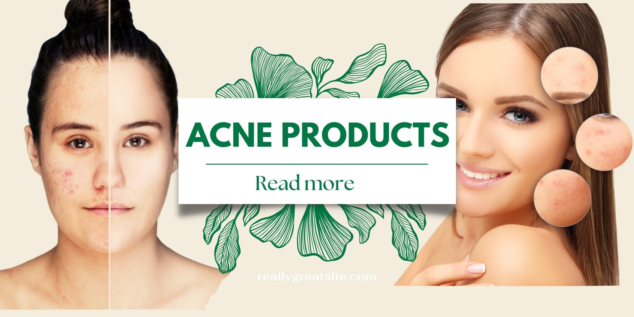 Achieve Flawless Skin with Our 4PCS Acne, Blackhead, Blemish Remover Kit and More - Ammpoure Wellbeing