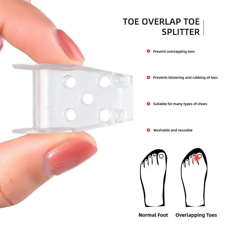 1pair Toe Orthosis Clip Pads Big Foot Bone Care Tools Splitter Thumb Hallux Valgus Bunion Corrector Overlap Separators - Ammpoure Wellbeing