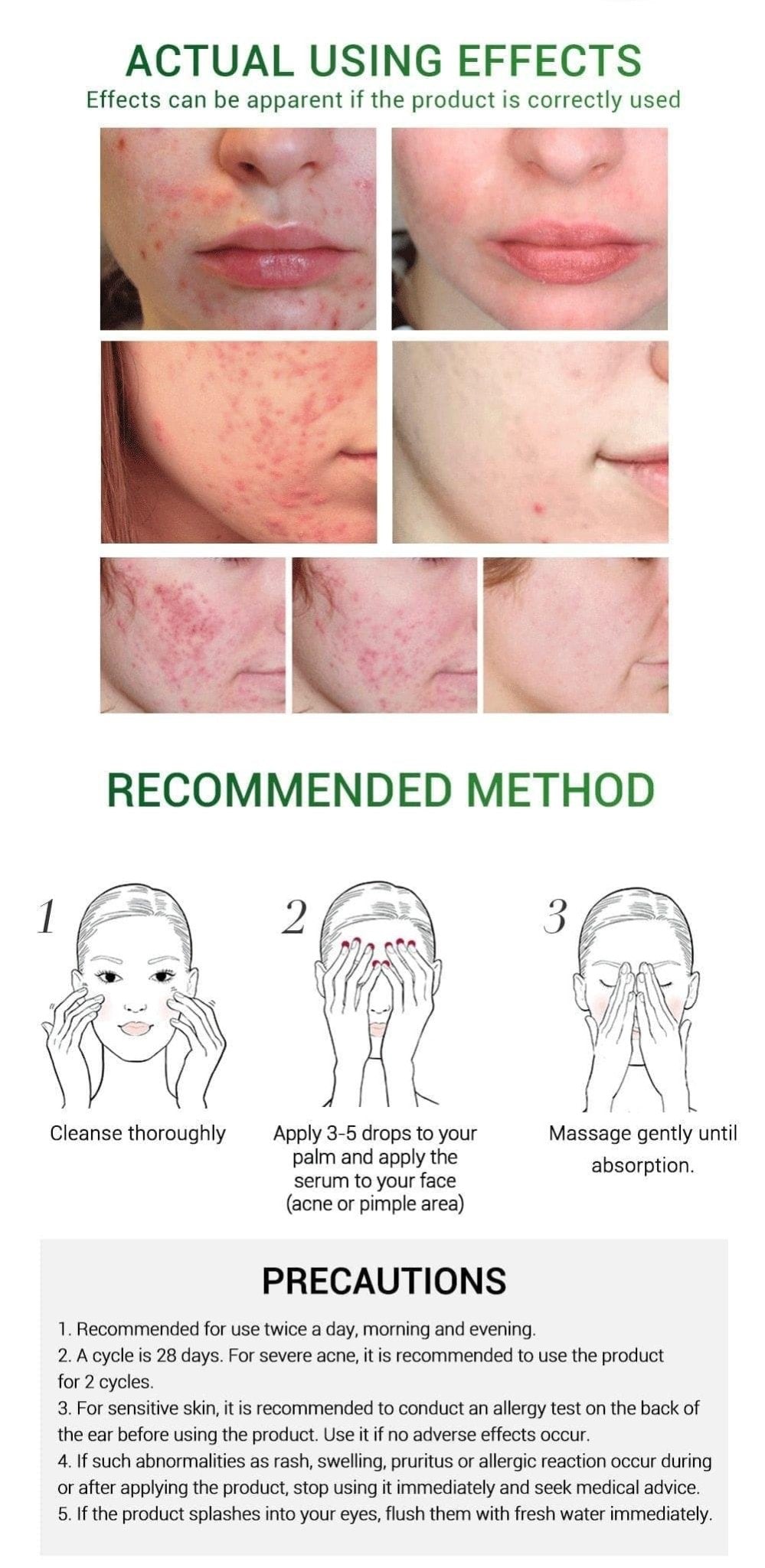 72 Pimple Acne Patches UK - Ammpoure Wellbeing