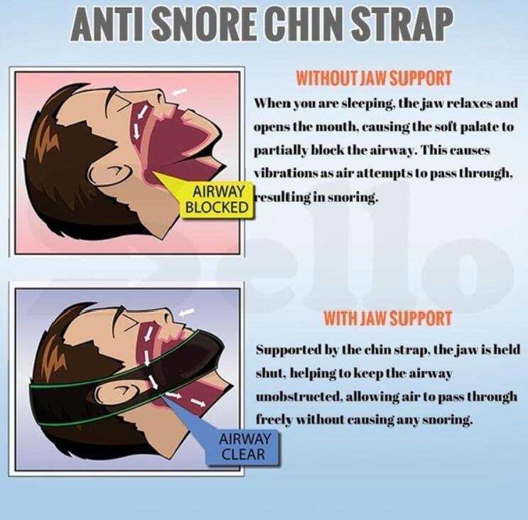 Neoprene Anti Snore Stop Snoring Chin Strap UK Belt Anti Apnea (black) - Ammpoure Wellbeing