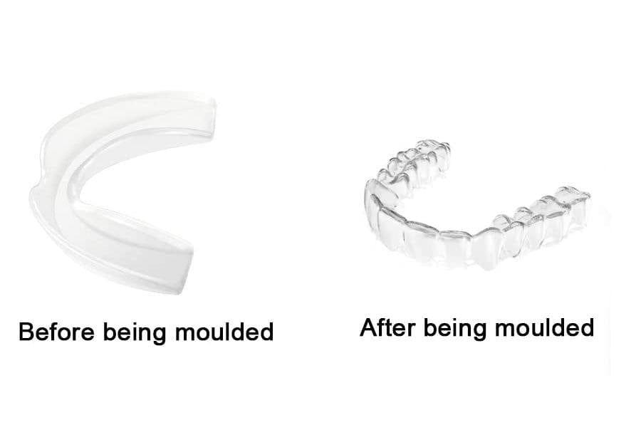 Pack of 4 Teeth Grinding Night Protector Athletic Mouth Guard UK Professional Dental Night Guard - Ammpoure Wellbeing